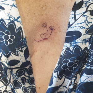 cicatrice exérèse grain de beauté