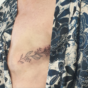 cicatrice mastectomie